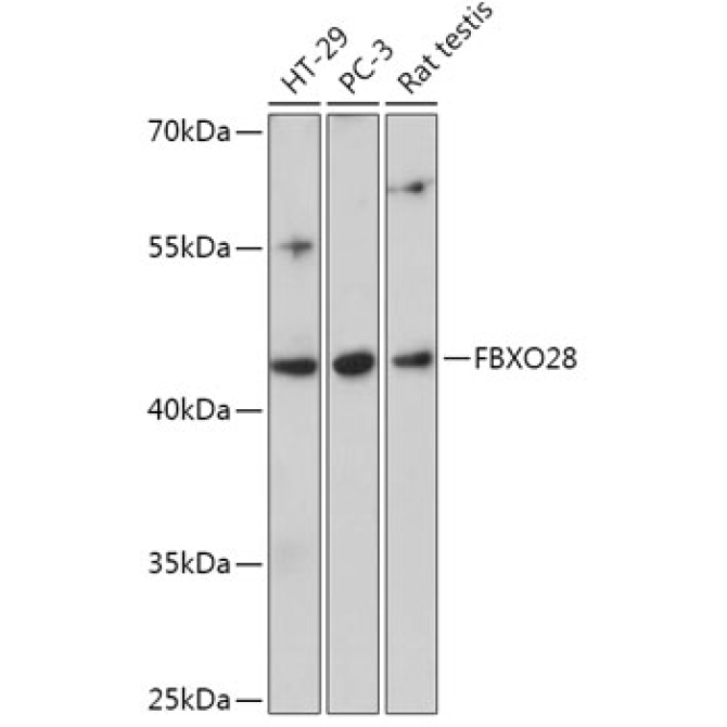 FBXO28 Rabbit Polyclonal Antibody