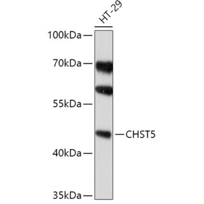 CHST5 Rabbit Polyclonal Antibody