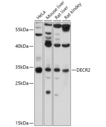 DECR2 Rabbit Polyclonal Antibody