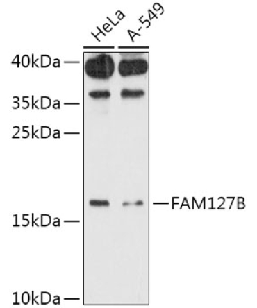 FAM127B Rabbit Polyclonal Antibody