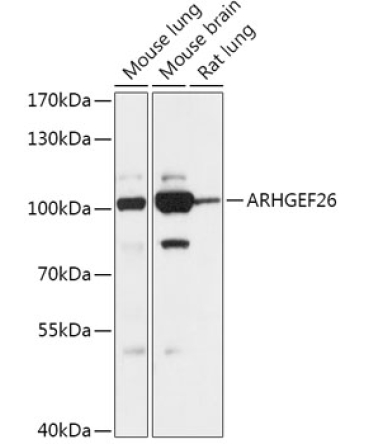 ARHGEF26 Rabbit Polyclonal Antibody