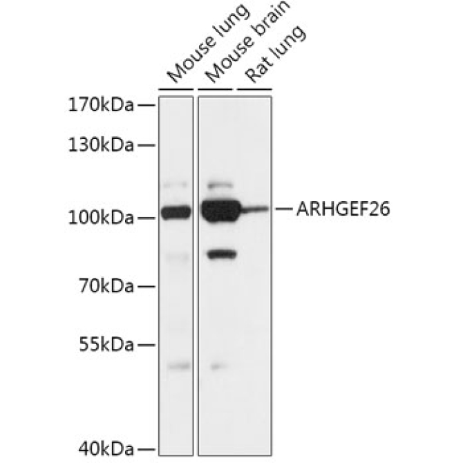 ARHGEF26 Rabbit Polyclonal Antibody