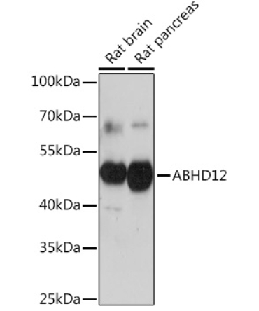 ABHD12 Rabbit Polyclonal Antibody