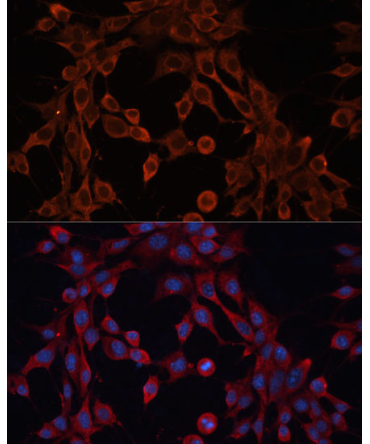 ABCA12 Rabbit Polyclonal Antibody