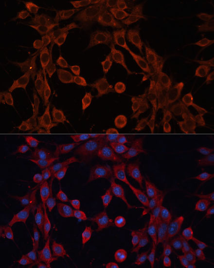 ABCA12 Rabbit Polyclonal Antibody