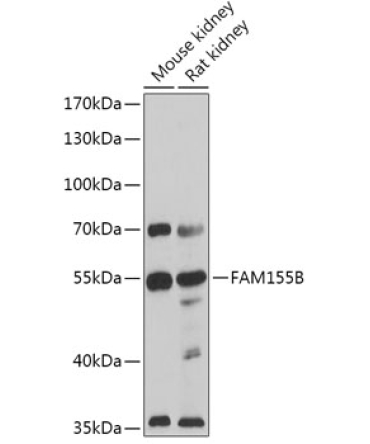 FAM155B Rabbit Polyclonal Antibody