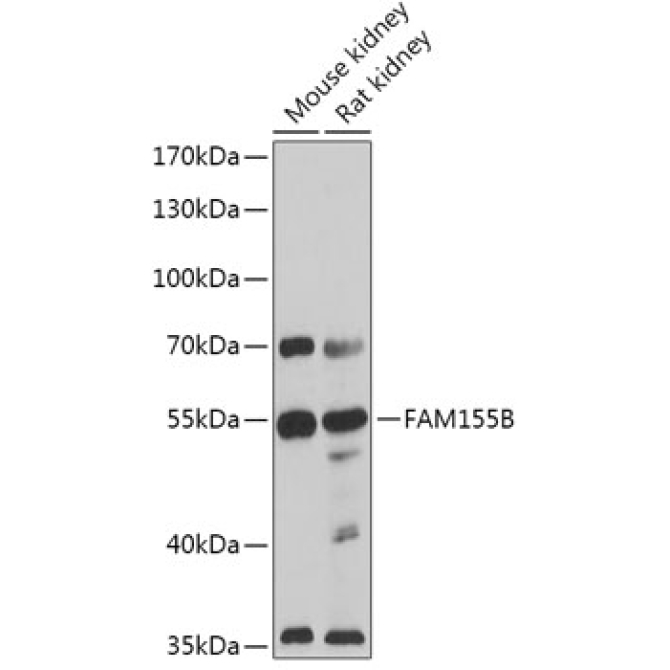 FAM155B Rabbit Polyclonal Antibody