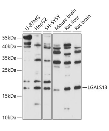 LGALS13 Rabbit Polyclonal Antibody