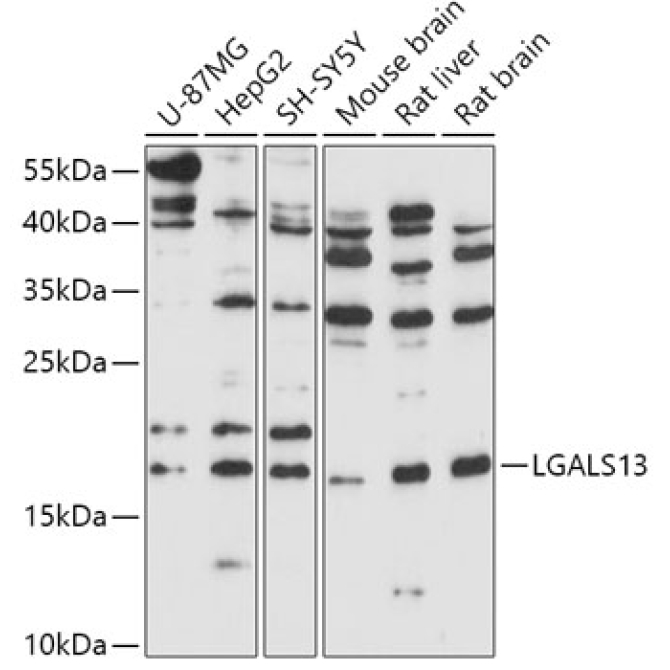 LGALS13 Rabbit Polyclonal Antibody