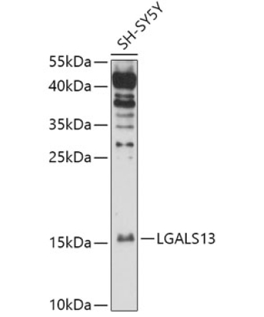 LGALS13 Rabbit Polyclonal Antibody