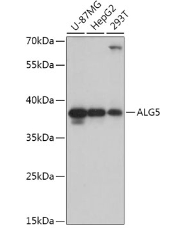 ALG5 Rabbit Polyclonal Antibody