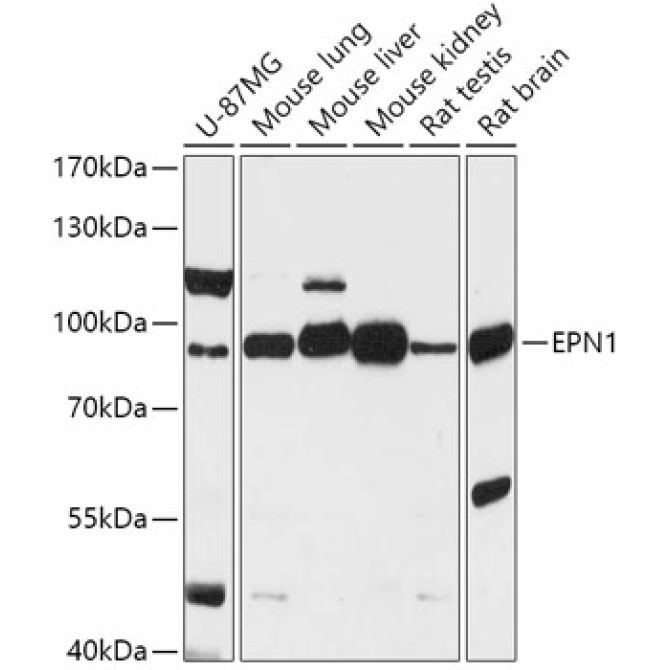 EPN1 Rabbit Polyclonal Antibody