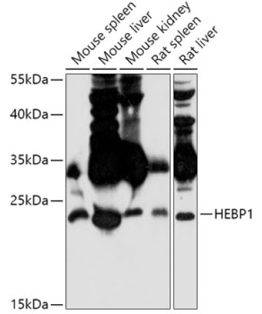 HEBP1 Rabbit Polyclonal Antibody