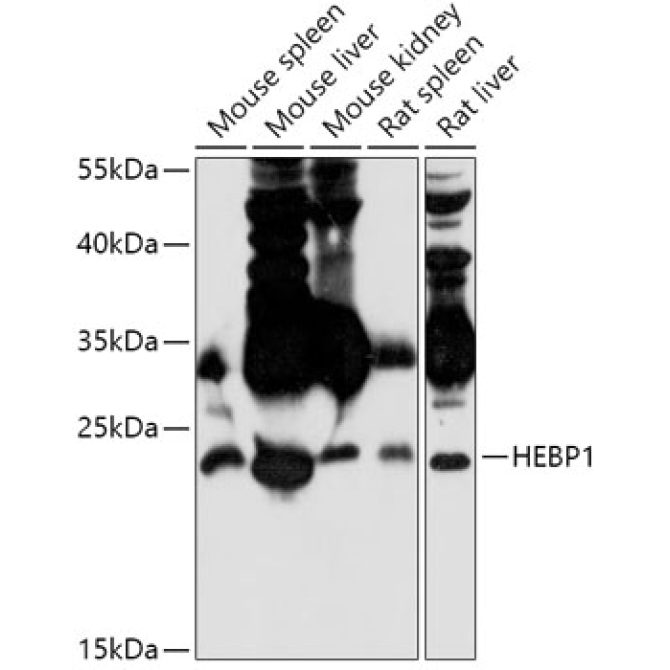 HEBP1 Rabbit Polyclonal Antibody