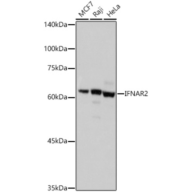 IFNAR2 Rabbit Polyclonal Antibody
