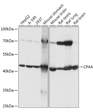 CPA4 Rabbit Polyclonal Antibody