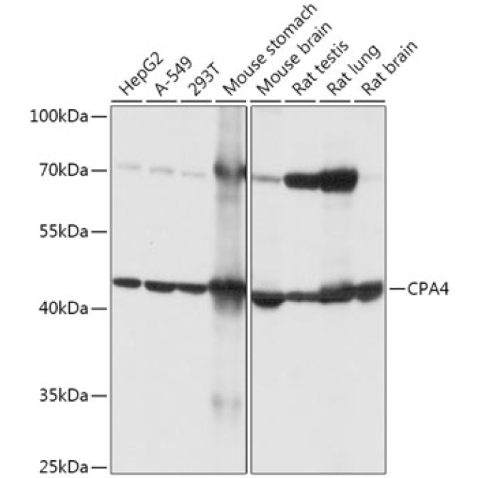 CPA4 Rabbit Polyclonal Antibody