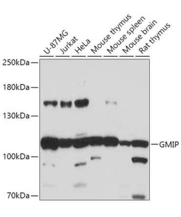 GMIP Rabbit Polyclonal Antibody