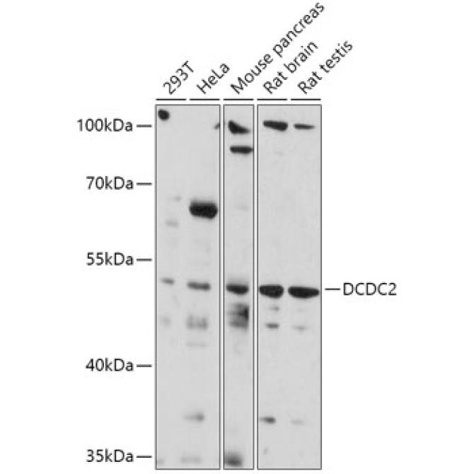 DCDC2 Rabbit Polyclonal Antibody