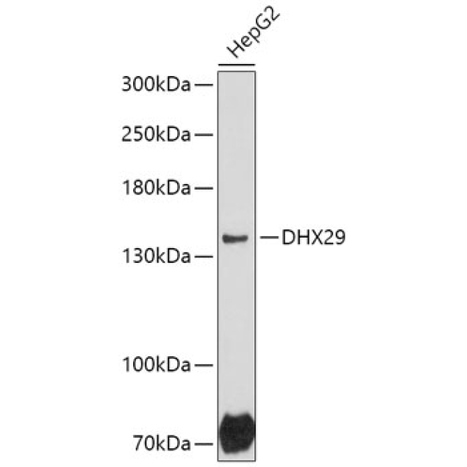 DHX29 Rabbit Polyclonal Antibody