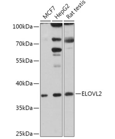 ELOVL2 Rabbit Polyclonal Antibody