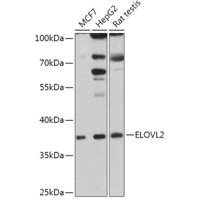 ELOVL2 Rabbit Polyclonal Antibody