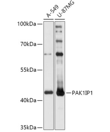 PAK1IP1 Rabbit Polyclonal Antibody