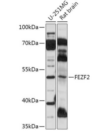 FEZF2 Rabbit Polyclonal Antibody