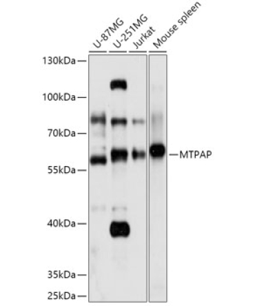 MTPAP Rabbit Polyclonal Antibody