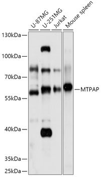 MTPAP Rabbit Polyclonal Antibody