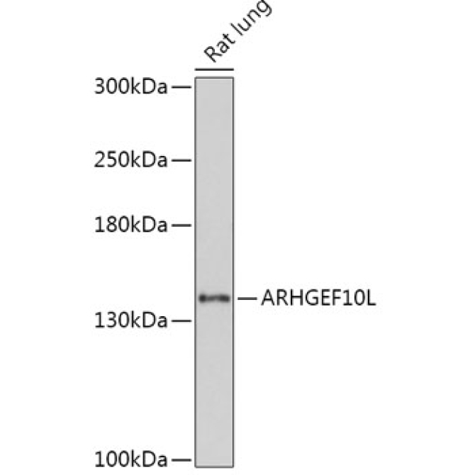 ARHGEF10L Rabbit Polyclonal Antibody
