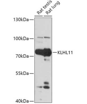 KLHL11 Rabbit Polyclonal Antibody