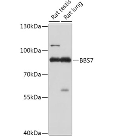 BBS7 Rabbit Polyclonal Antibody