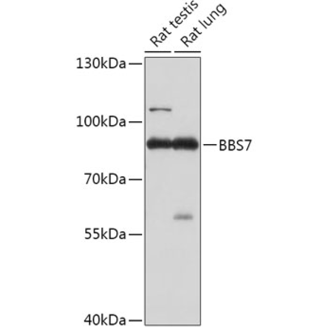 BBS7 Rabbit Polyclonal Antibody