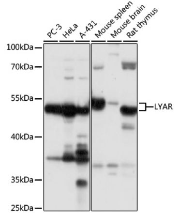 LYAR Rabbit Polyclonal Antibody