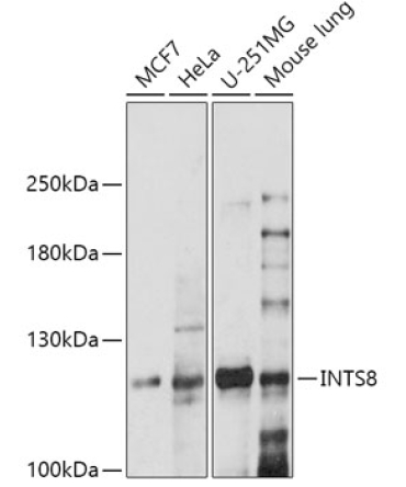 INTS8 Rabbit Polyclonal Antibody