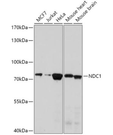 NDC1 Rabbit Polyclonal Antibody