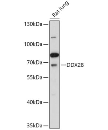 DDX28 Rabbit Polyclonal Antibody