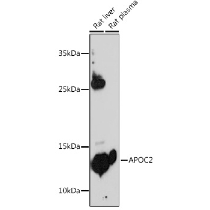 APOC2 Rabbit Polyclonal Antibody