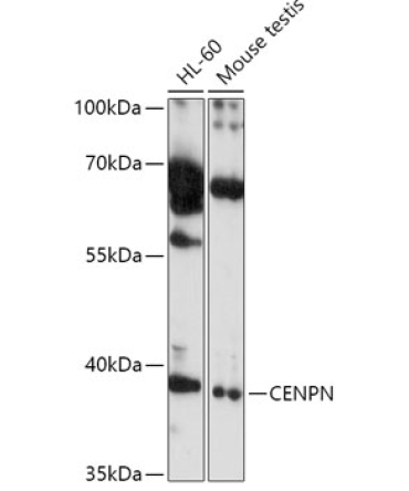 CENPN Rabbit Polyclonal Antibody