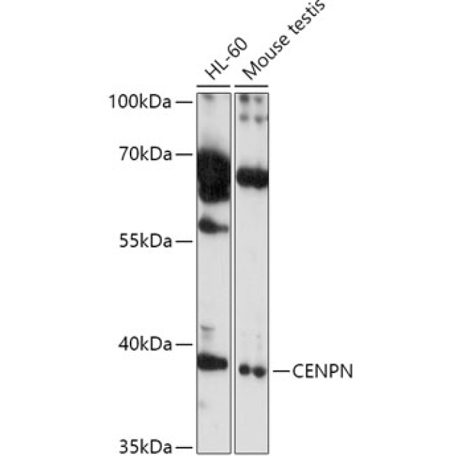 CENPN Rabbit Polyclonal Antibody