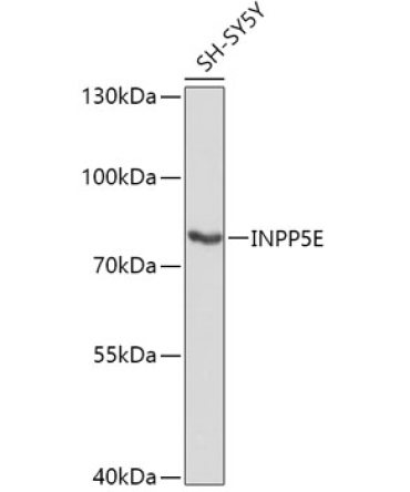 INPP5E Rabbit Polyclonal Antibody
