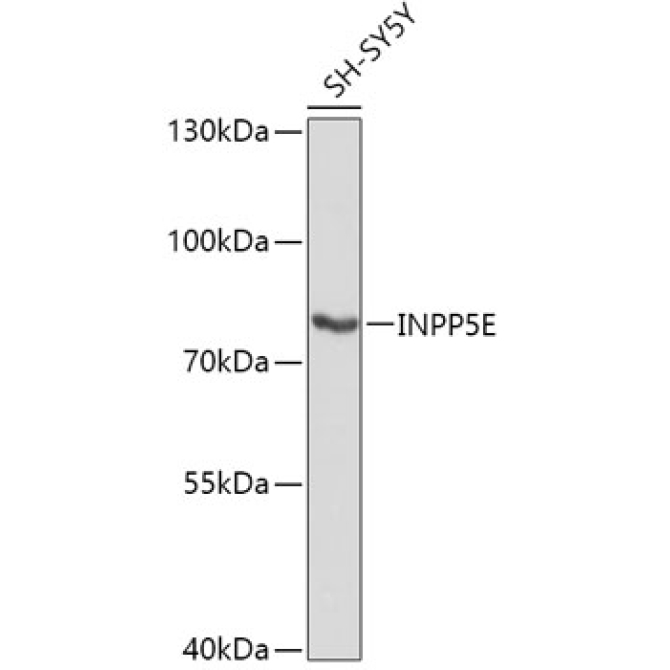 INPP5E Rabbit Polyclonal Antibody