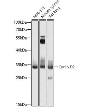 Cyclin D2 Rabbit Polyclonal Antibody