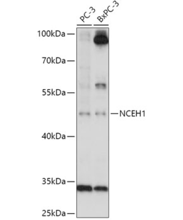 NCEH1 Rabbit Polyclonal Antibody