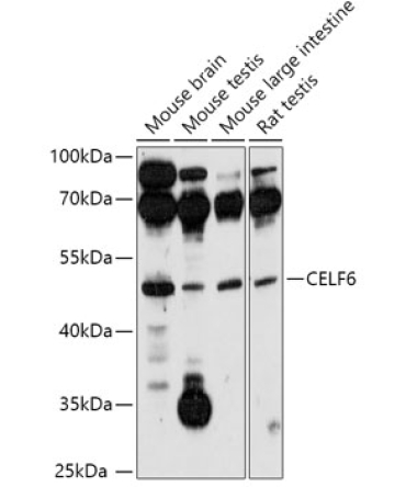 CELF6 Rabbit Polyclonal Antibody