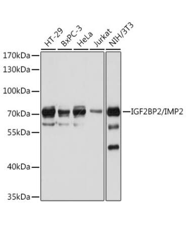 IGF2BP2/IMP2 Rabbit Polyclonal Antibody