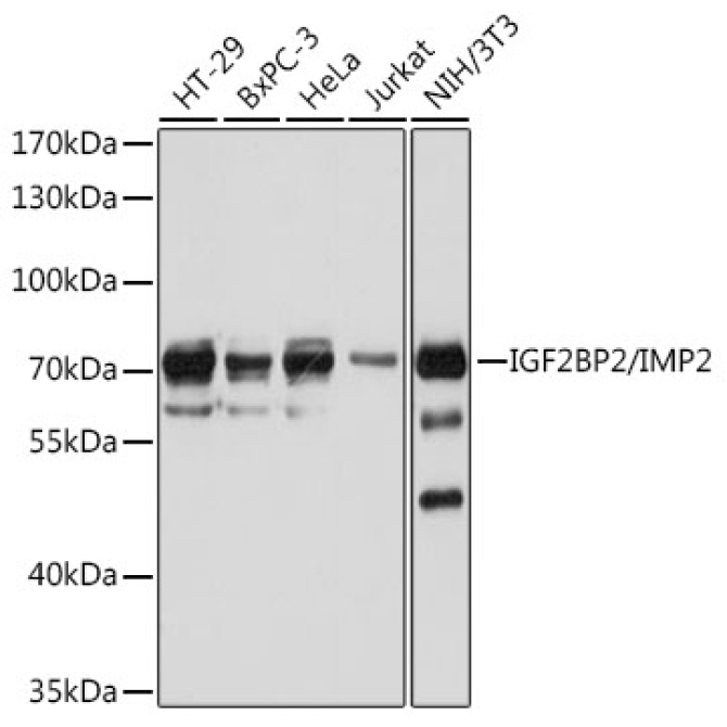 IGF2BP2/IMP2 Rabbit Polyclonal Antibody