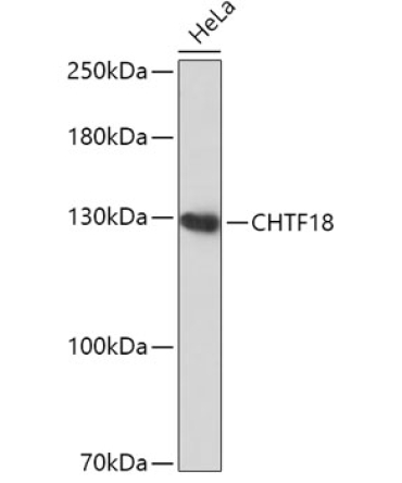 CHTF18 Rabbit Polyclonal Antibody