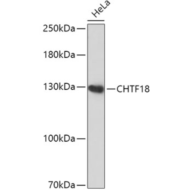 CHTF18 Rabbit Polyclonal Antibody